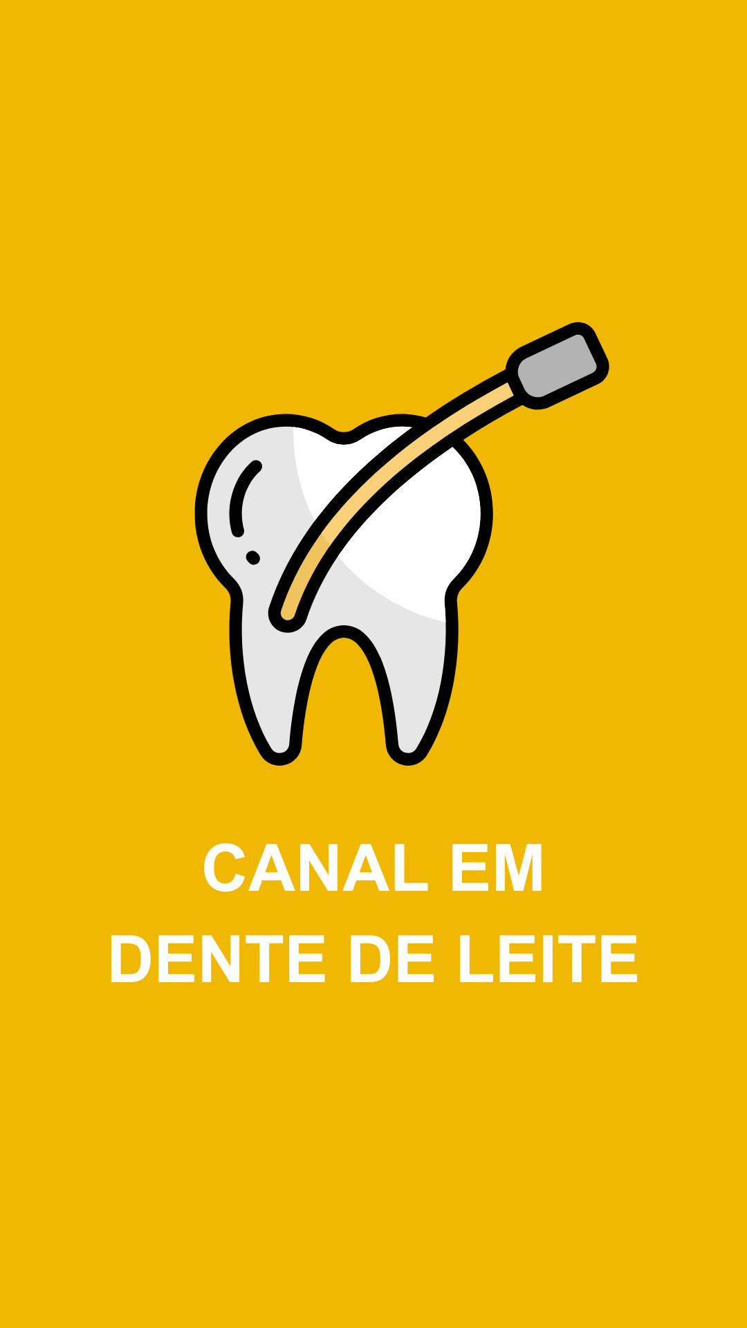 Leia mais sobre o artigo Canal em Dente de Leite